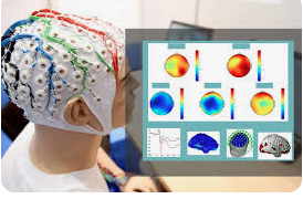 معرفی بهترین انواع EEG برای گرفتن نوار مغز در منزل 